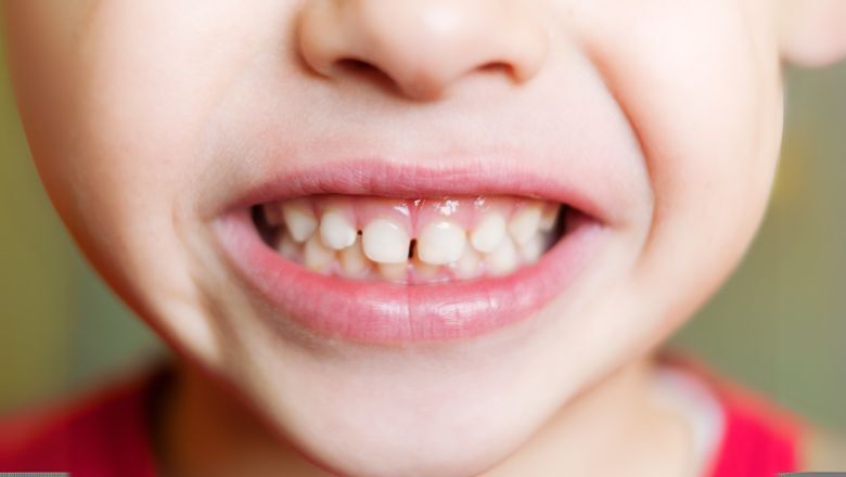 Hidden Sugar Bombs Beyond Candy, What's Really Hurting Your Kid's Teeth
